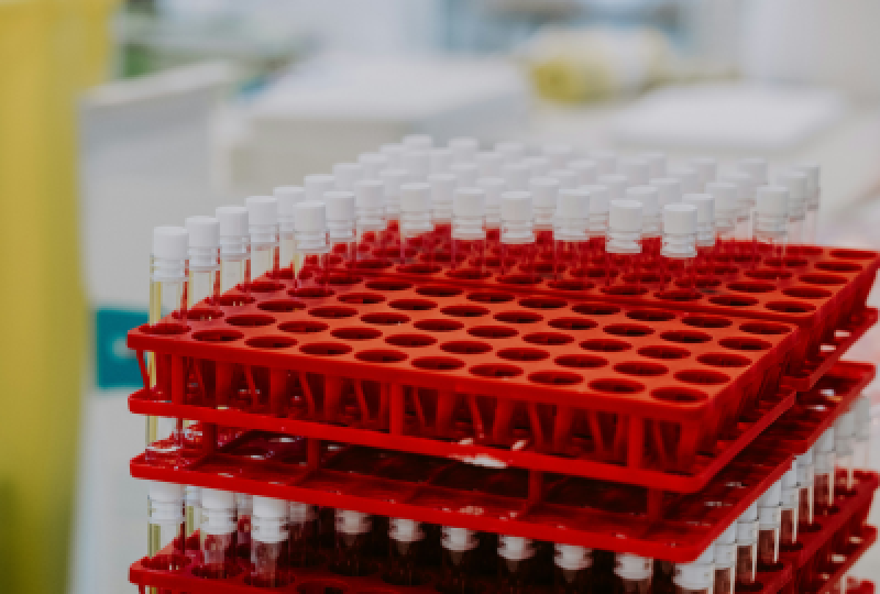 Protoporfiria eritropoietica: cauze, simptome si opțiuni de tratament