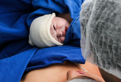 Malformatiile congenitale: De ce apar, cum se pot preveni, tipuri de tratament