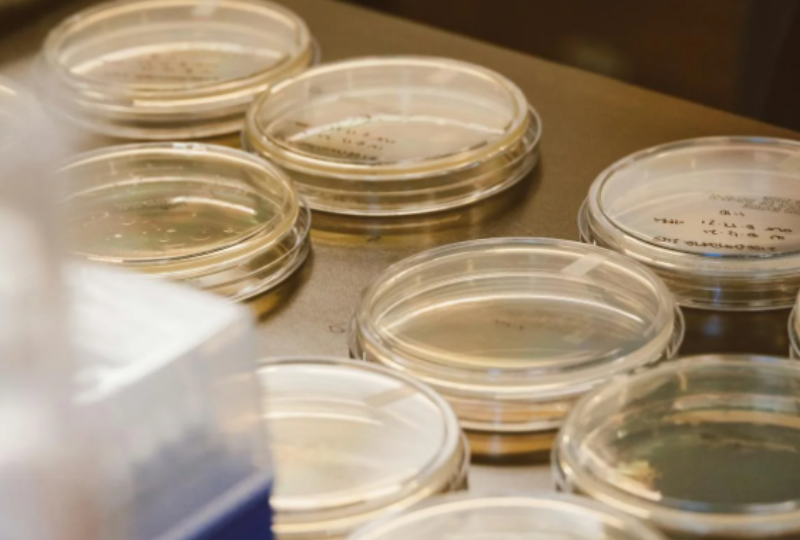 Bacterii infectioase: Ce este infectia cu Shigella si cum ne putem proteja