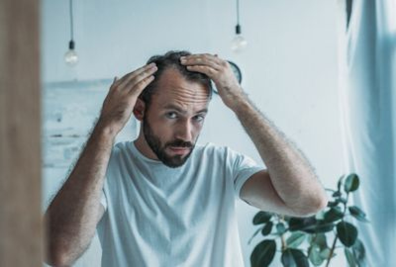 Alopecia: ce este si care sunt cauzele?