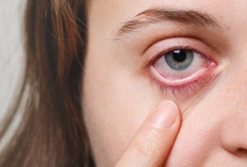 Blefarita: Cum apare si cum se poate trata, moduri de preventie