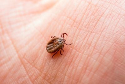 Boala Lyme - cauze, diagnostic si tratament