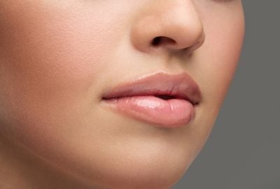 Cheilita angulara: cum apare, preventie si tratament