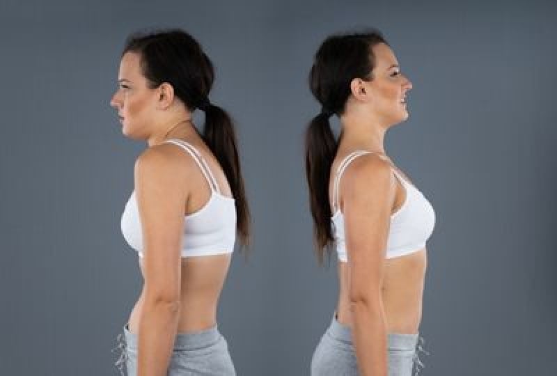 Sindromul Marfan: simptome, diagnostic si tratament