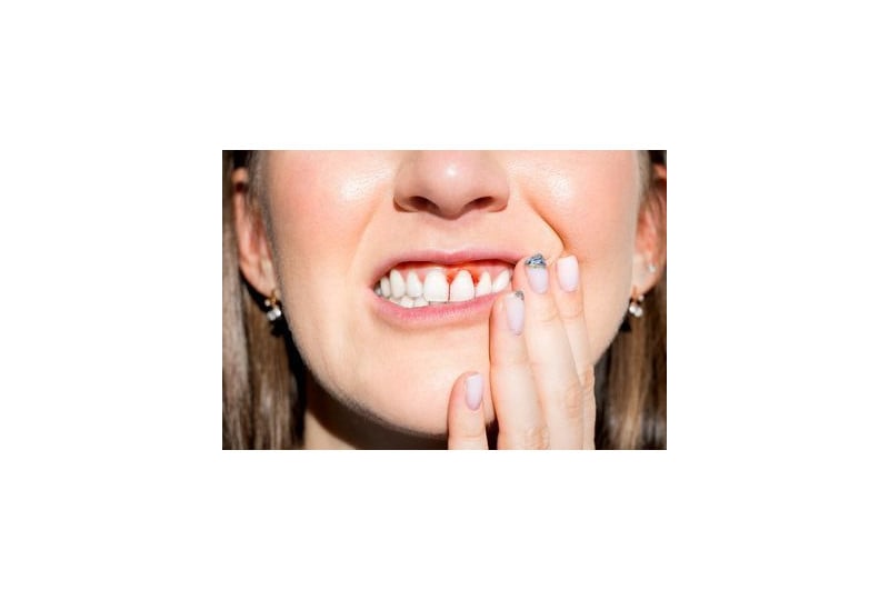 Gingivita: ce este, cauze, simptome si preventie