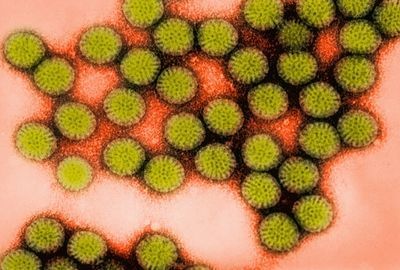 Infectia cu rotavirus cauze, simptome, tratament