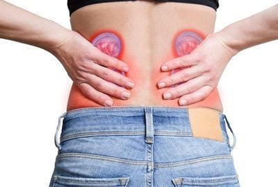 Pietrele la rinichi la femei. cauze si preventie
