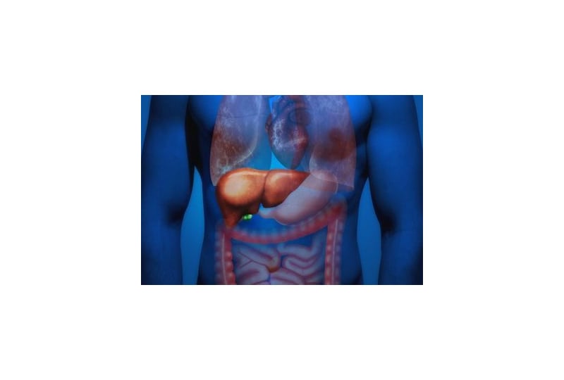 Steatoza hepatica sau ficatul gras: Cum apare, simptome, tratament