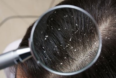 Tipuri de matreata si solutii de preventie
