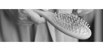 Căderea părului la femei: cauze, tratamente și cele mai bune vitamine