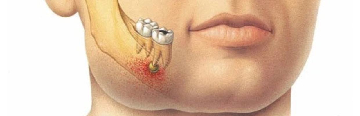 Dr. Inorica Alina Pripici: Infectiile dentare ascunse pot afecta pielea. Cum se ajunge de la acnee la inflamatii cronice