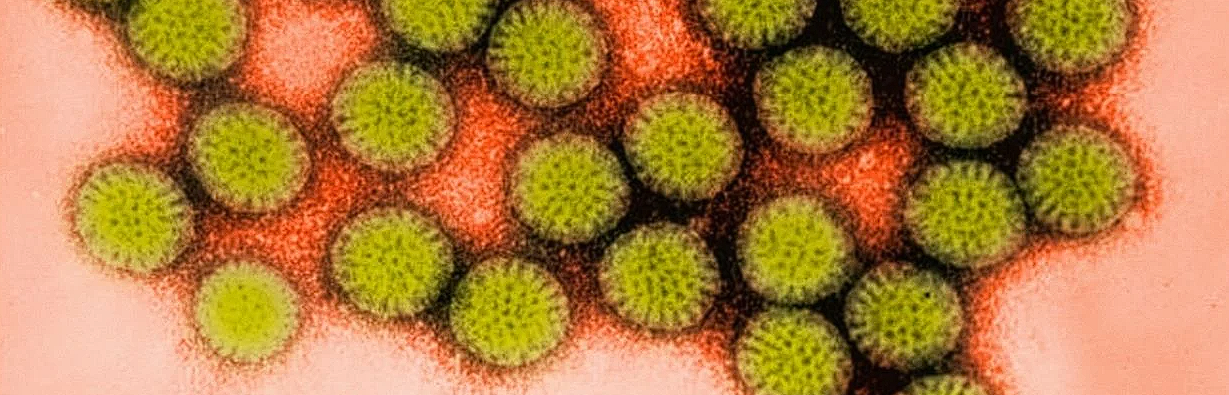 Ebola: Tot ce trebuie sa stii despre aceasta boala infectioasa