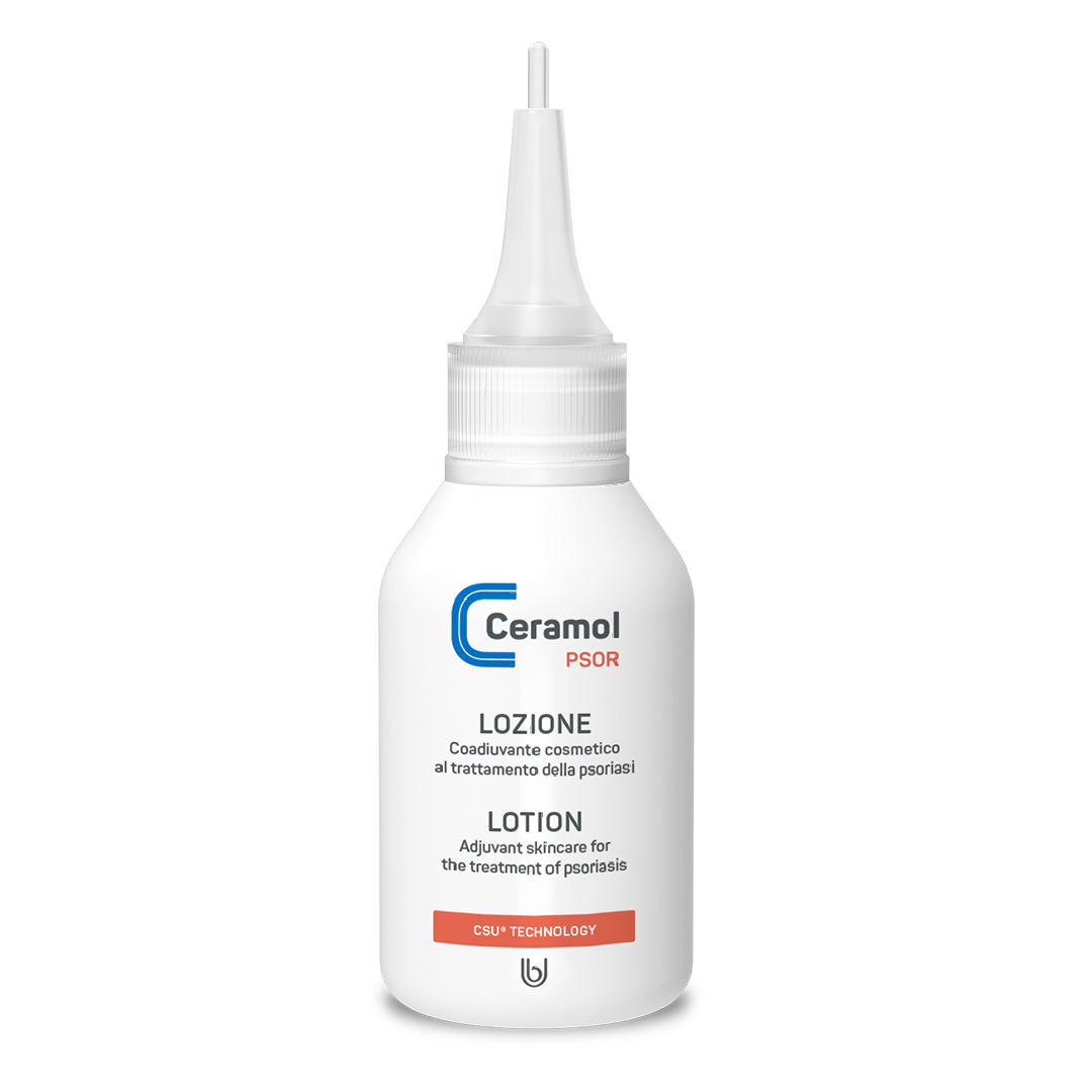 Lotiune pentru psoriazis CeraPSOR, 50 ml, Ceramol