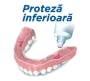 proteza dentară inferioară cum se aplică crema adezivă pe proteza dentară înferioară