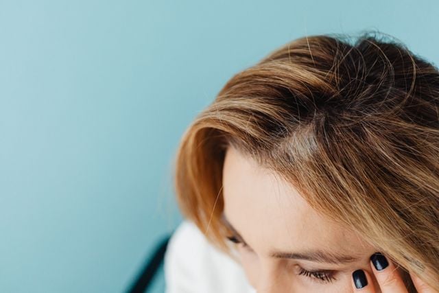 Scalp cu semne de alopecie