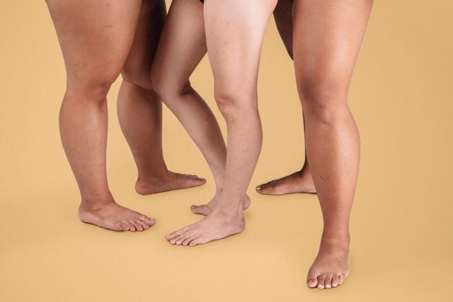 piele predispusa la celulita piele predispusa la celulita