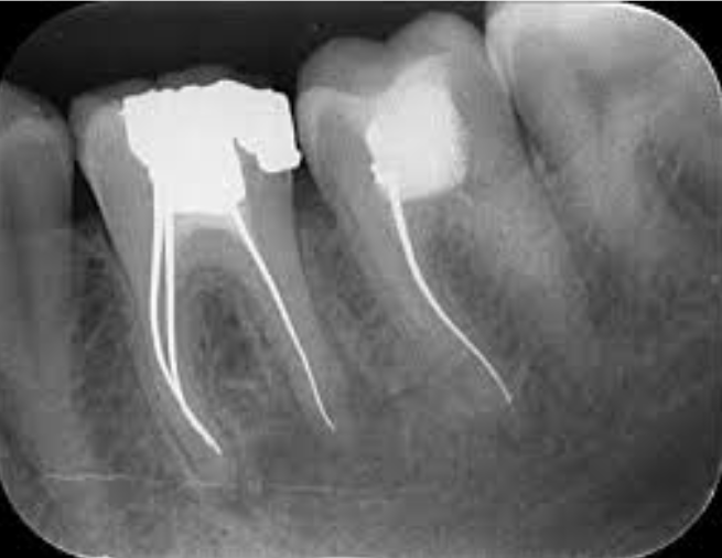 radiografie_dentara