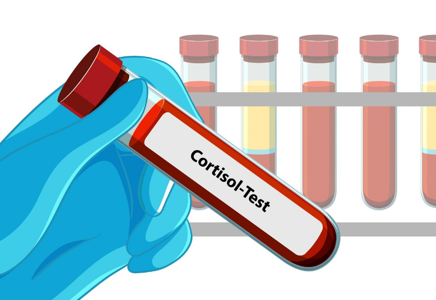 Grafica cu test nivel de cortizol din organism