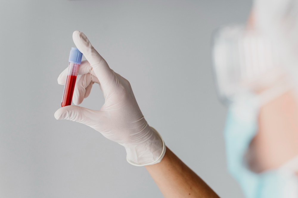 Test de sange pentru boala Graves