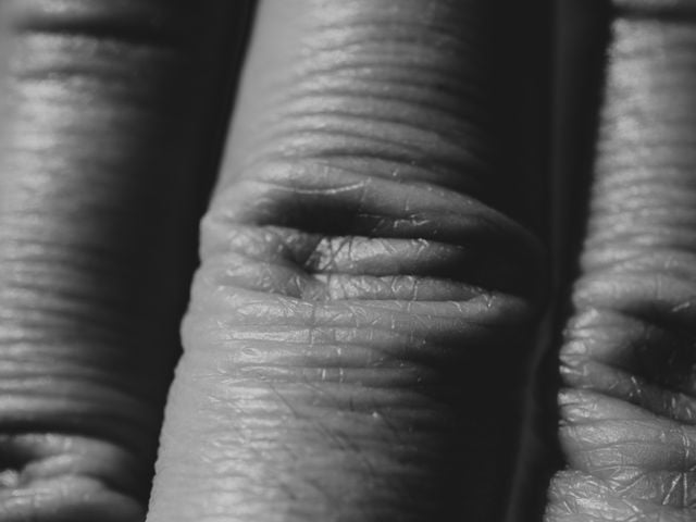 degete_uscate_microscop degete_uscate_microscop