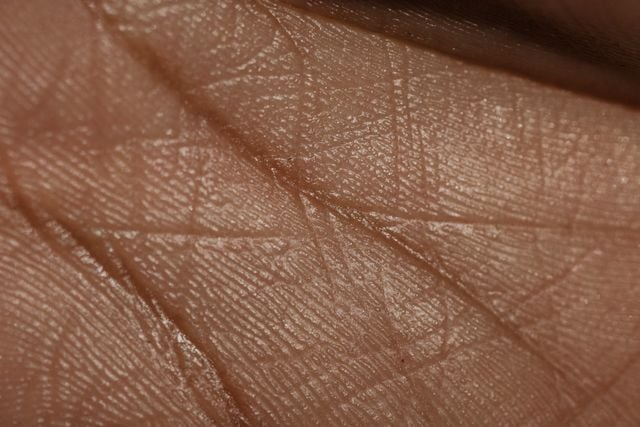 cum_se_vede_pielea_uscata_microscop cum_se_vede_pielea_uscata_microscop