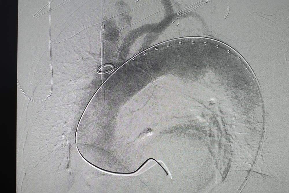 Imagine angiografie